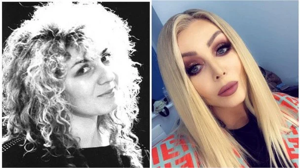 Ірина Білик - до та після пластичної операції / © instagram.com/bilyk_iryna